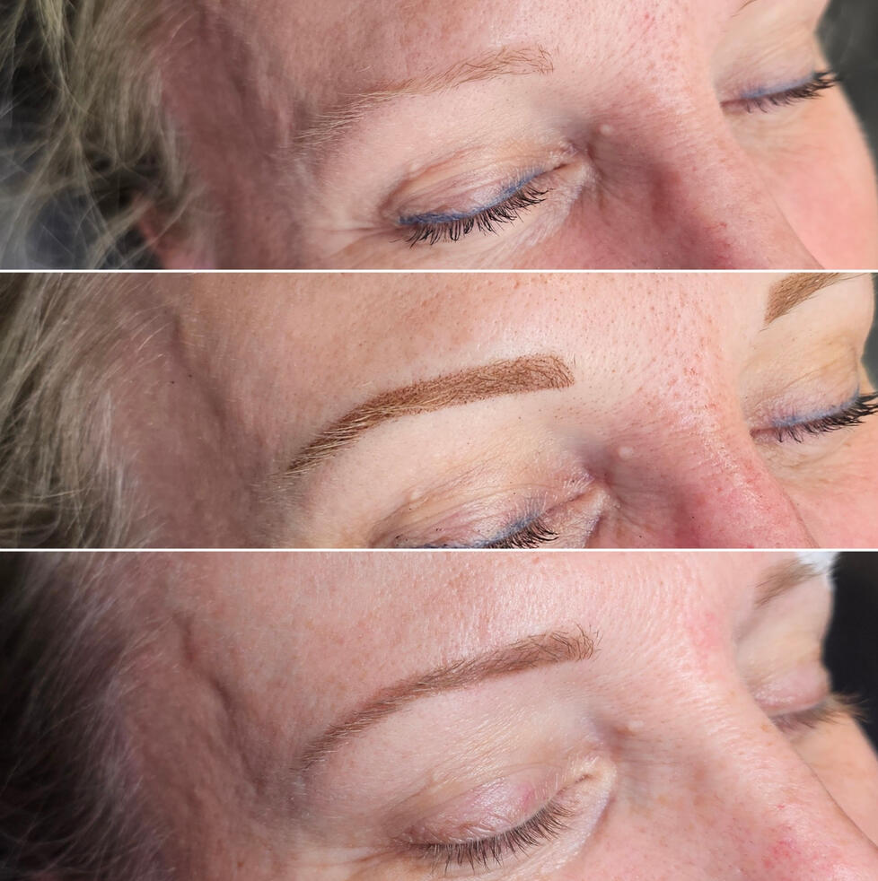 healed before touch up